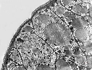 celiakia … reduced microvilli, lipid droplets celiakia … reduced microvilli, lipid droplets